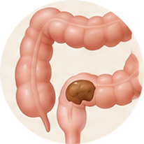 Colon: Adds Soft Bulk